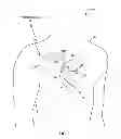 Fig. 02 - Automatic selection of electrode vectors for assessing risk of heart failure decompensation events