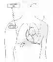 Fig. 01 - RESPIRATORY FUNCTION DETECTION