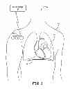 Fig. 02 - RESPIRATORY FUNCTION DETECTION