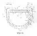 Fig. 04 - Sensor over-mold shape