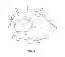 Fig. 04 - APPARATUSES AND METHODS FOR EVALUATING A PATIENT