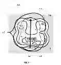 Fig. 08 - Devices and methods for increased blood flow and pain control