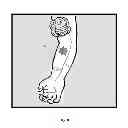 Fig. 09 - Devices and methods for increased blood flow and pain control