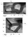 Fig. 02 - Palmar thumb and thumb saddle joint splint