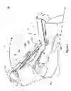 Fig. 02 - ADJUSTABLE DORSAL NIGHT SPLINT