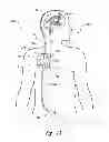 Fig. 02 - Body fluid drainage system