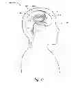 Fig. 09 - Body fluid drainage system