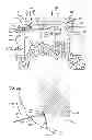 Fig. 03 - Dissection handpiece with aspiration means for reducing the appearance of cellulite