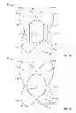 Fig. 02 - Devices and methods for treating accidental bowel leakage