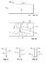 Fig. 08 - Devices and methods for treating accidental bowel leakage