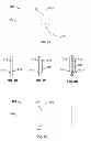 Fig. 09 - Devices and methods for treating accidental bowel leakage