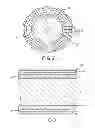 Fig. 03 - Catheter shaft and method of its manufacture