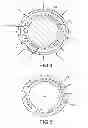 Fig. 04 - Catheter shaft and method of its manufacture