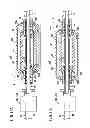 Fig. 14 - Fixing device and catheter set