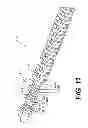 Fig. 12 - Methods and systems for attaching medical device sections
