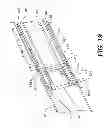 Fig. 20 - Methods and systems for attaching medical device sections