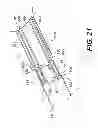 Fig. 22 - Methods and systems for attaching medical device sections