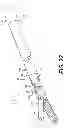 Fig. 23 - Methods and systems for attaching medical device sections