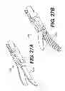 Fig. 29 - Methods and systems for attaching medical device sections