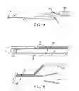 Fig. 02 - Safety urinary catheter