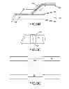 Fig. 04 - Safety urinary catheter