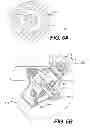 Fig. 06 - Medical device having a tensionable coupling