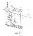 Fig. 07 - Medical device having a tensionable coupling