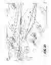 Fig. 22 - Medical device having a tensionable coupling