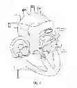 Fig. 07 - Balloon design to enhance cooling uniformity