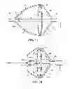 Fig. 08 - Balloon design to enhance cooling uniformity
