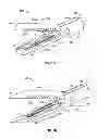 Fig. 02 - Multi-functional medical device and related methods of use