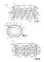 Fig. 02 - Composite and surface mounted brace, kit and assembly for supporting a fractured bone