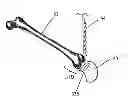 Fig. 01 - Total joint arthroplasty system