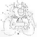 Fig. 01 - Surgical instrumentation specific to a patient for preparing a bone of the patient