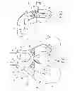 Fig. 02 - Surgical instrumentation specific to a patient for preparing a bone of the patient