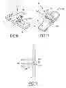 Fig. 07 - Surgical instrumentation specific to a patient for preparing a bone of the patient