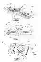 Fig. 09 - Surgical instrumentation specific to a patient for preparing a bone of the patient
