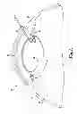 Fig. 02 - Ocular lens capsule retainer