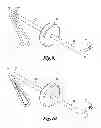 Fig. 09 - Ocular lens capsule retainer