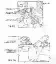 Fig. 02 - Devices, systems and methods for minimally invasive surgery of the throat and other portions of mammalian body