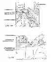 Fig. 02 - Devices, systems and methods for minimally invasive surgery of the throat and other portions of mammalian body