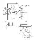 Fig. 01 - Extendable suction surface for bracing medical devices during robotically assisted medical procedures