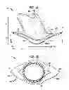 Fig. 02 - IMPLANTABLE FLOW CONNECTOR