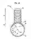 Fig. 07 - IMPLANTABLE FLOW CONNECTOR