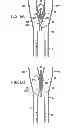 Fig. 07 - DEVICE FOR CLOSING LUMINAL CAVITY AND METHOD THEREFOR