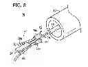 Fig. 09 - DEVICE FOR CLOSING LUMINAL CAVITY AND METHOD THEREFOR