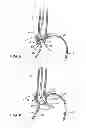 Fig. 09 - INTRALUMINAL DEVICES AND METHODS FOR DENERVATION