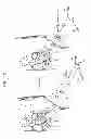 Fig. 04 - MINIMALLY INVASIVE SURGICAL TECHNIQUES