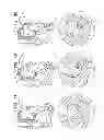 Fig. 09 - MINIMALLY INVASIVE SURGICAL TECHNIQUES