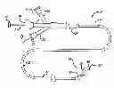 Fig. 01 - Long nose manipulatable catheter